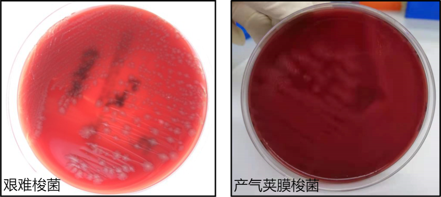 产气荚膜梭菌油镜图片