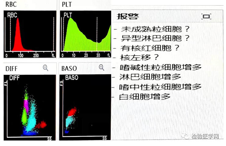 一份来自外周血的提示,揭开异常血常规结果的神秘面纱