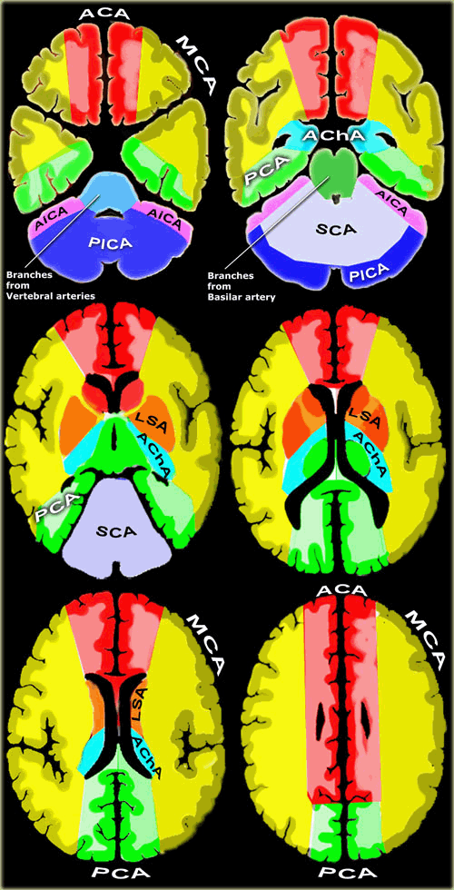 豆纹动脉天蓝acha:脉络膜前动脉墨绿branches from basilar artery