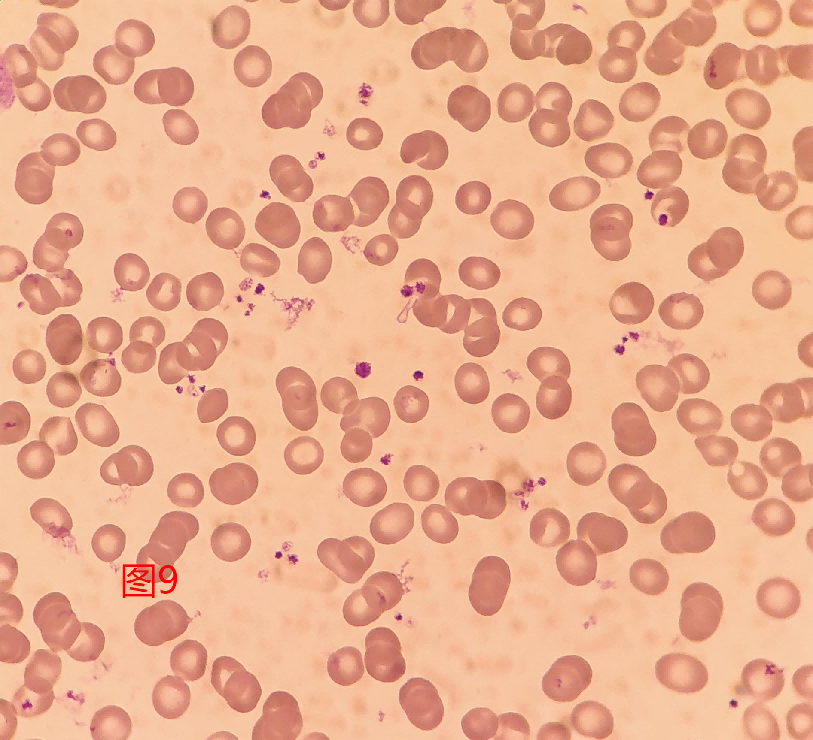 血小板镜下图片图片