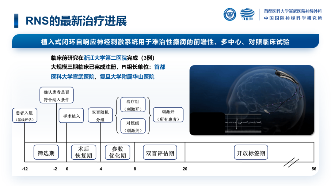 宣武医院单永治:基于脑机接口的国产rns临床初探