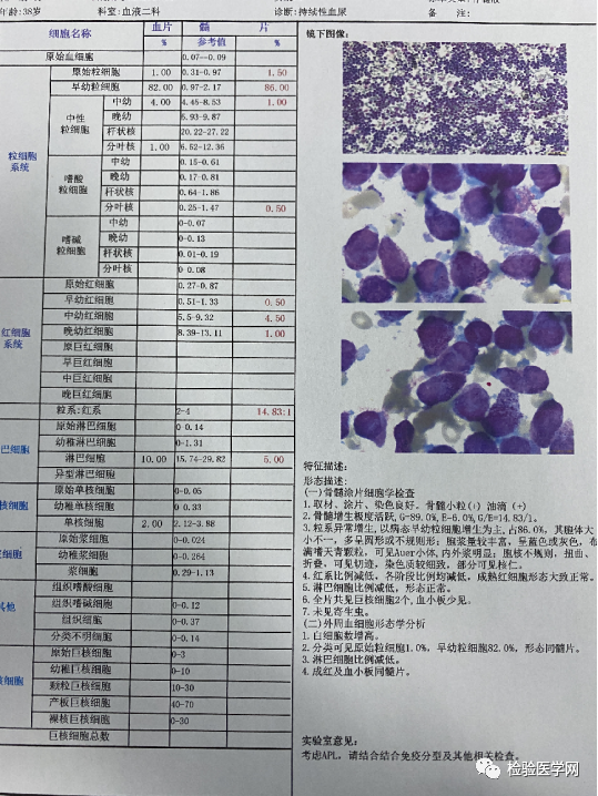 血涂片报告图片