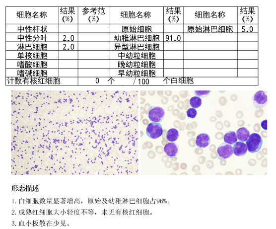 血涂片报告图片