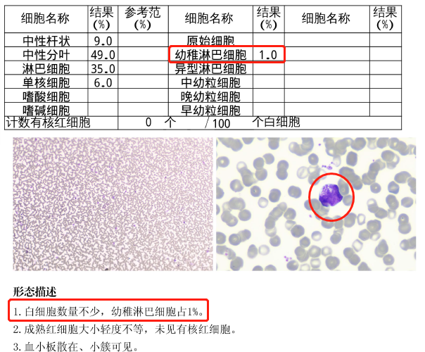 外周血涂片报告图片