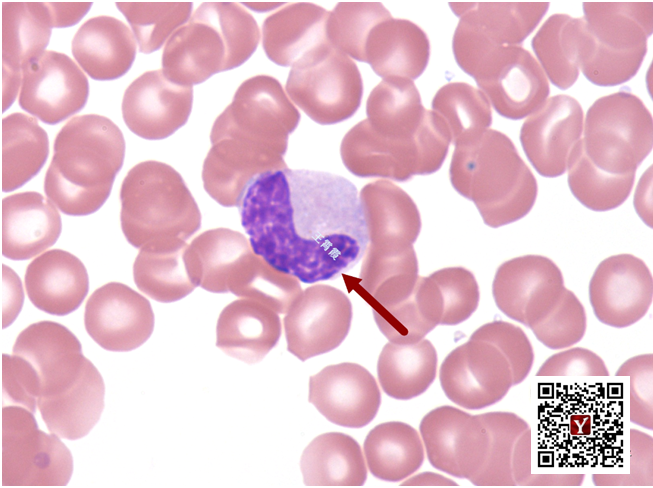 中性杆状核粒细胞图片