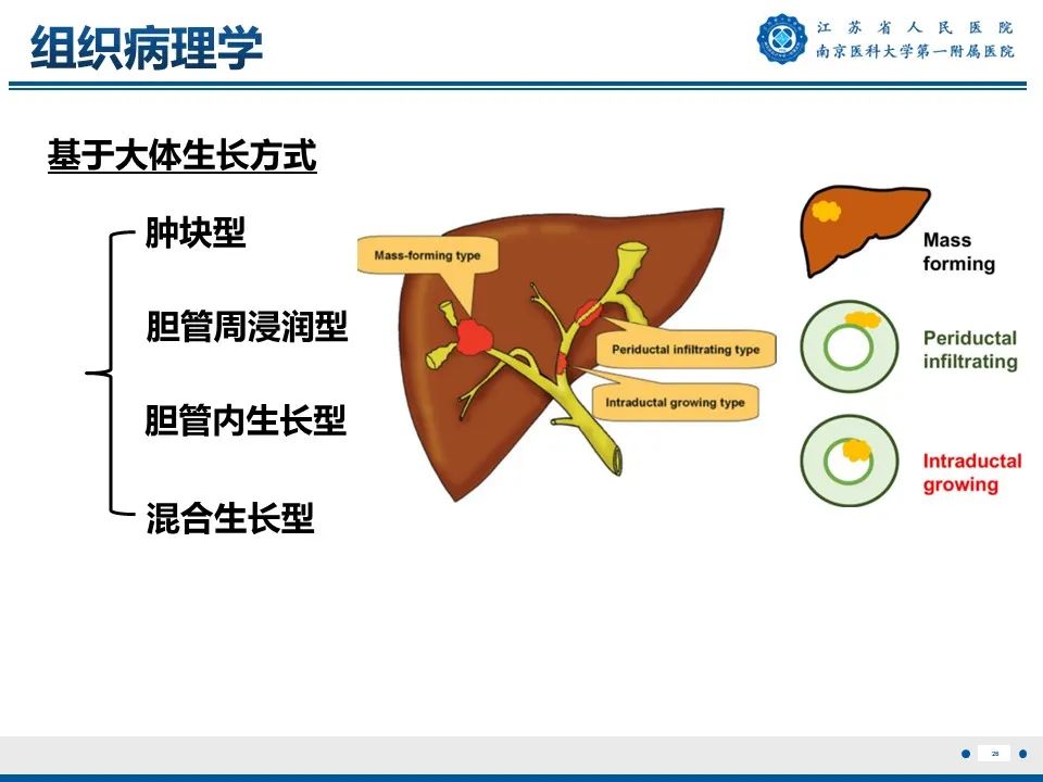 胆管癌的分期–胆管癌 _ 胆管癌は治りますか _ G-CSF産生肝内胆管原発腺扁平上皮癌の1例 – GWBPMU