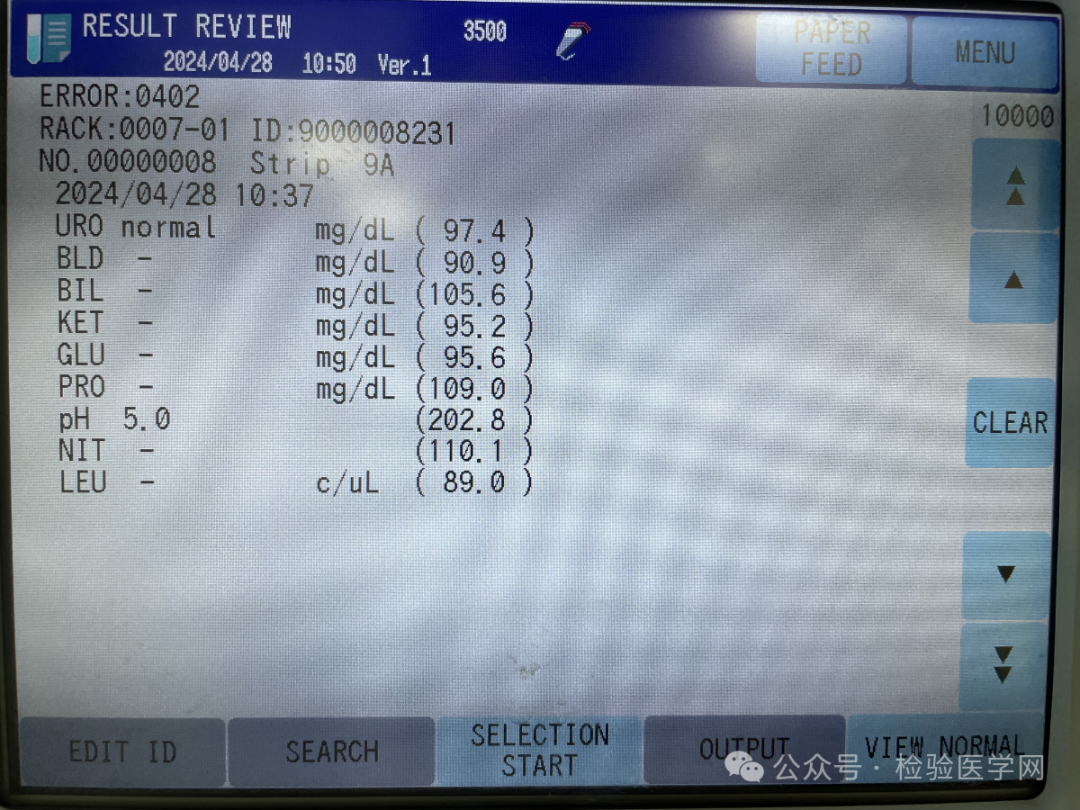 将红茶上机检测,uc-3500全自动尿干化学分析仪和uf-4000全自动尿有