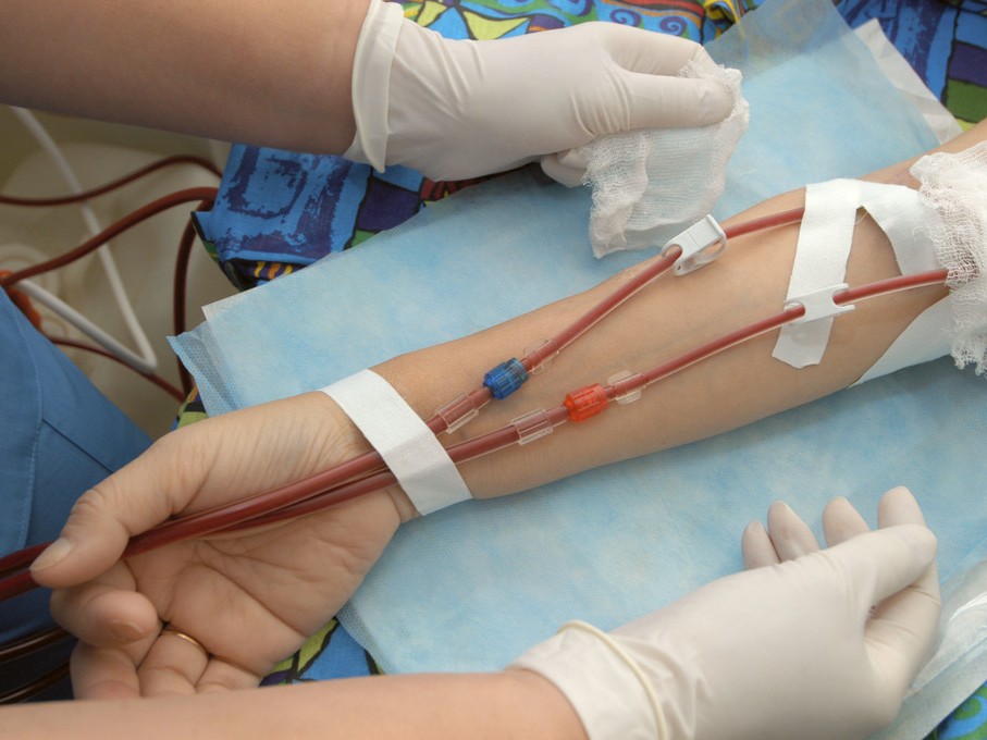 测量的血浆渗透压和计算的血浆渗透压是一致的吗 医学界 助力医生临床决策和职业成长