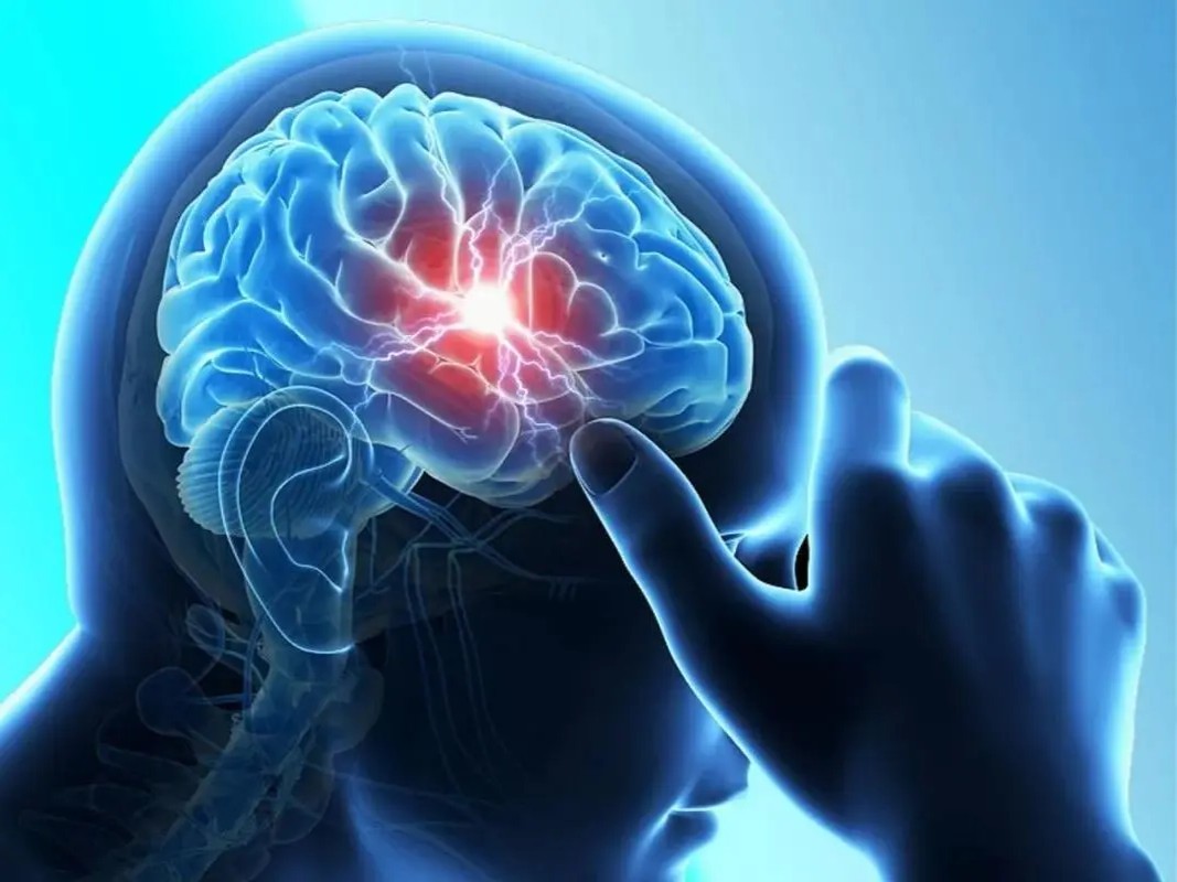 头疼怎么办（头痛的4个日常方法 或许能帮你缓解！） | 说明书网