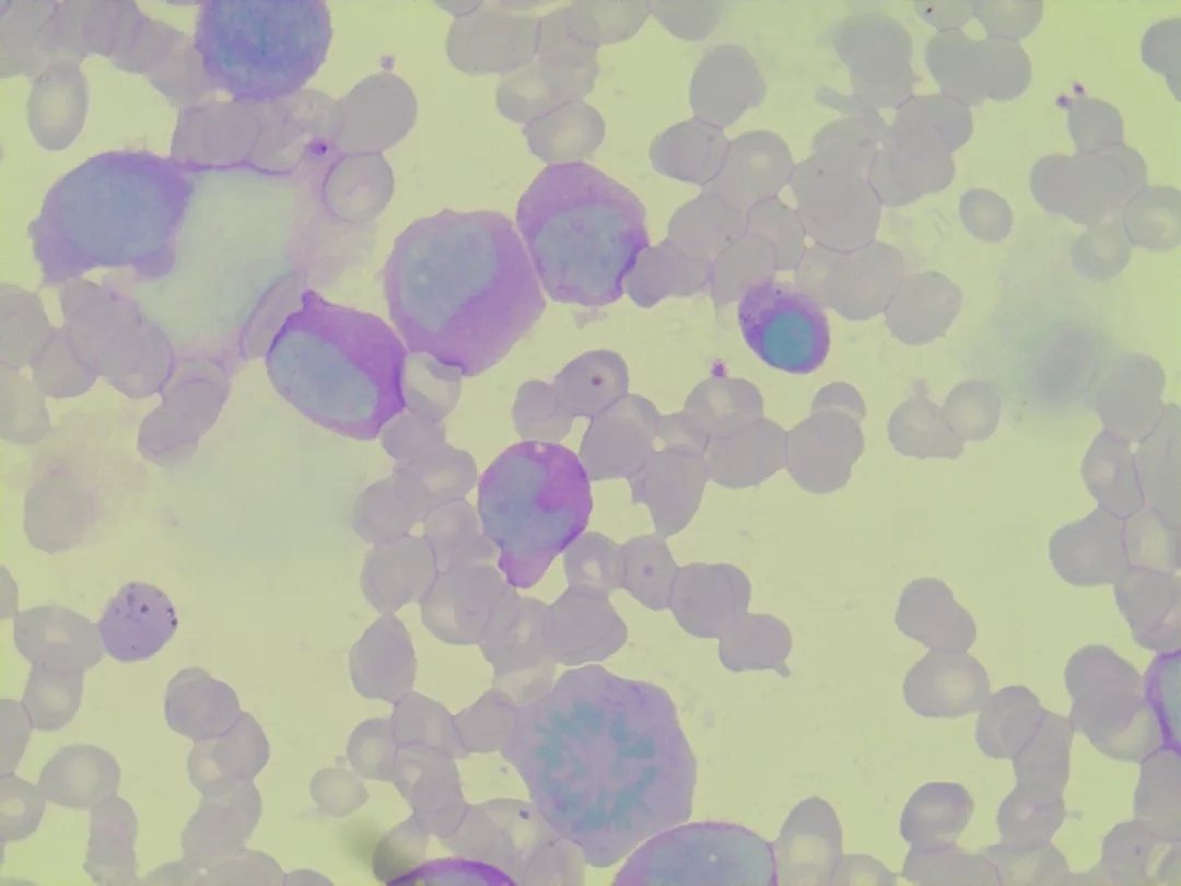 潘氏细胞染色图片
