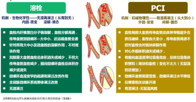 心梗了吃药溶栓还是介入取栓指南表示全都要