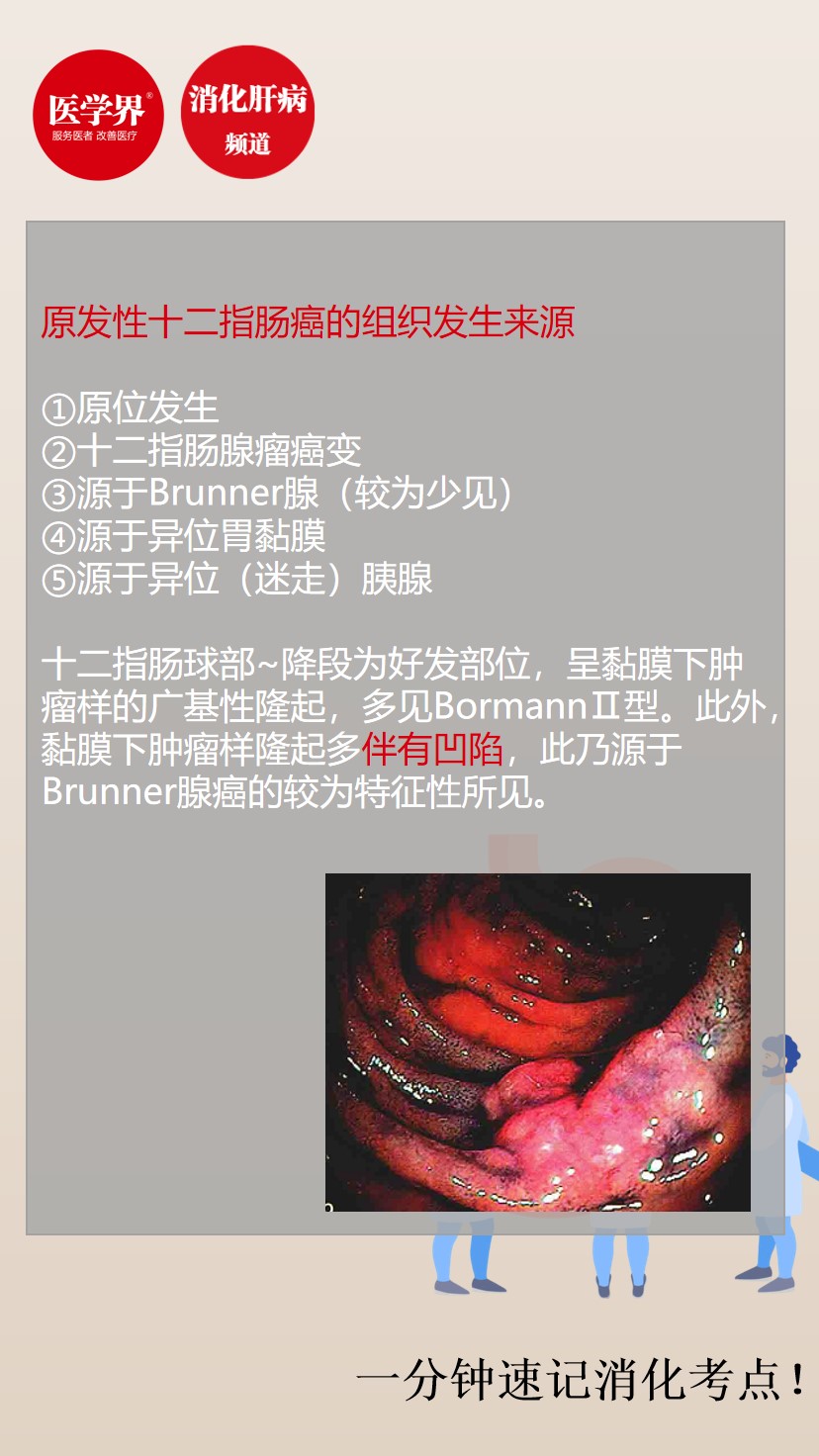 一分钟速记原发性十二指肠癌的组织发生来源