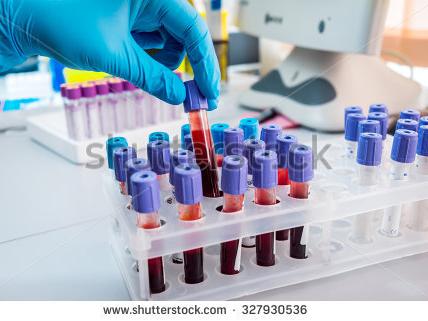 一套血培养为何选择1个需氧+1个厌氧的组合?_医学界-助力医生临床决策和职业成长