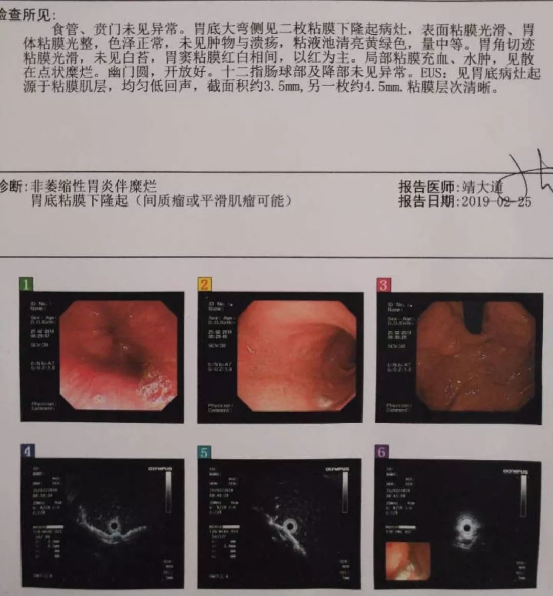 病例 02 频繁嗳气