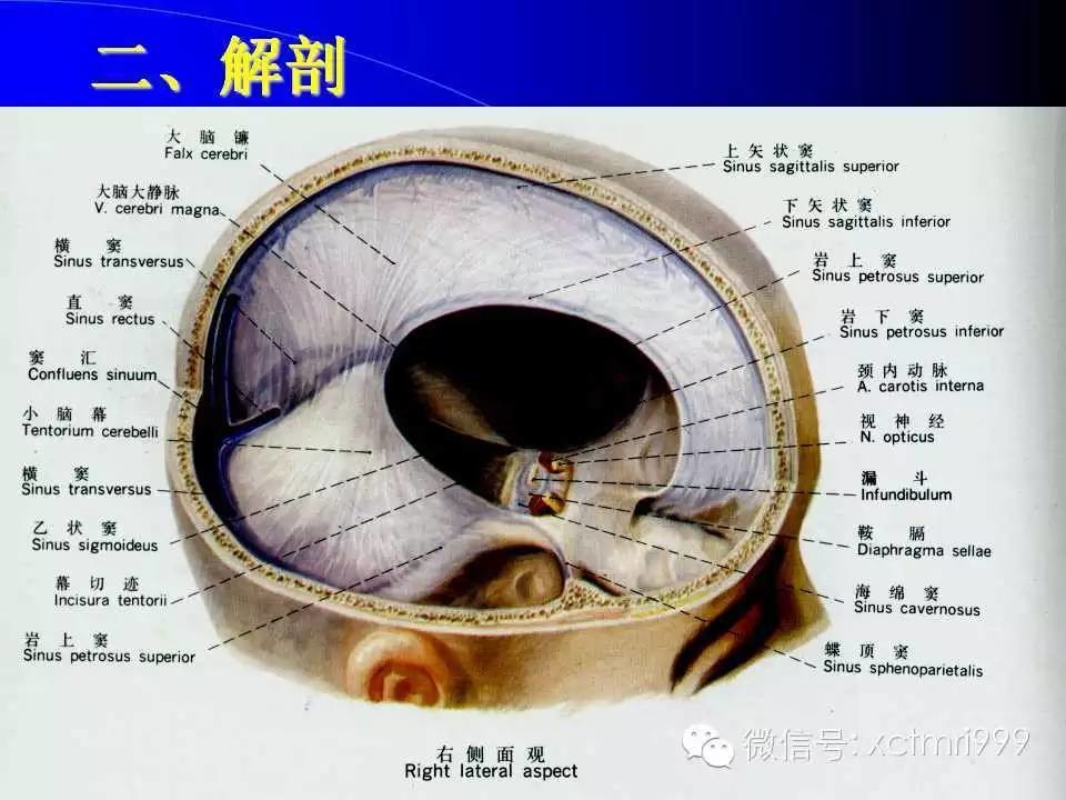 腦靜脈竇血栓特徵_醫學界-助力醫生臨床決策和職業成長