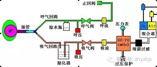 呼吸机---不再是冰冷的机器