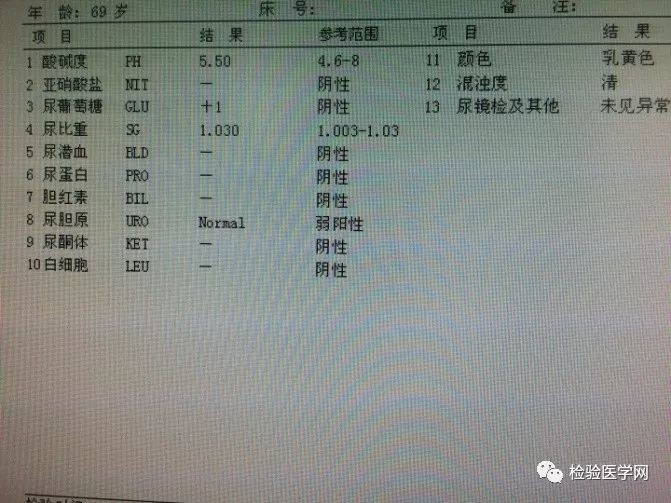 一例浑浊尿导致的尿干化学检测假阴性