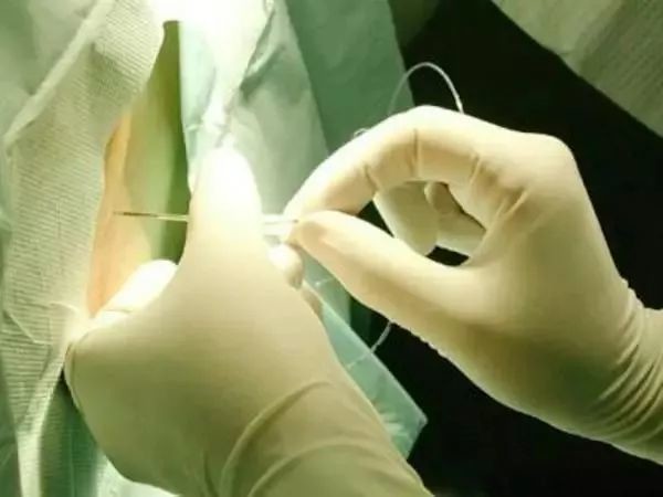 大手术小麻醉,还是小手术大麻醉?_医学界-助力医生临床决策和职业成长