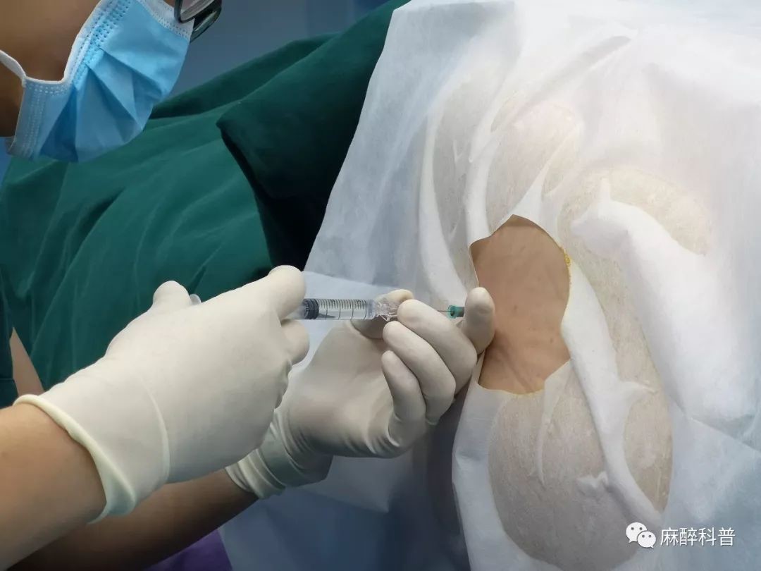 11次,我亲历麻醉_医学界-助力医生临床决策和职业成长