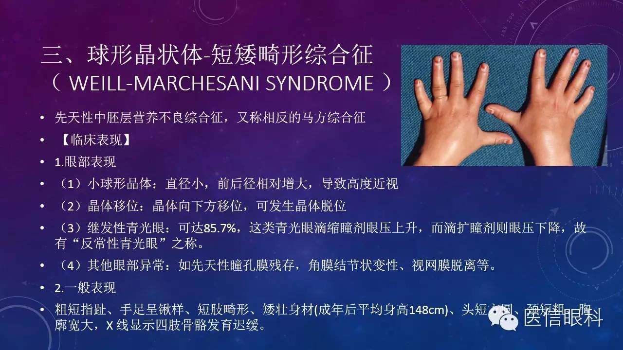 眼科常见综合征_医学界-助力医生临床决策和职业成长