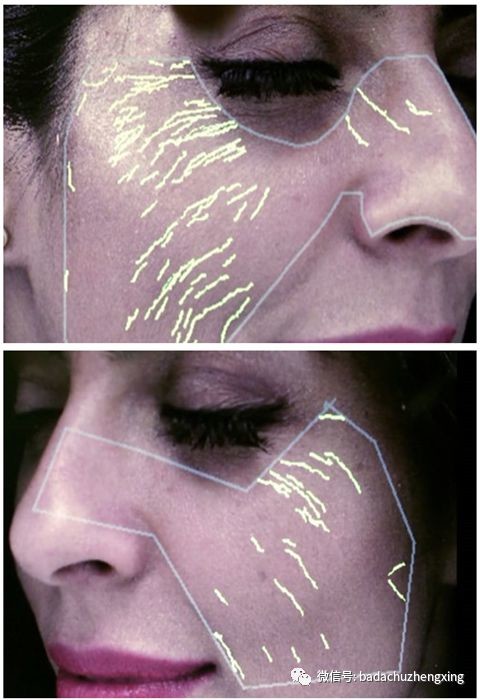 守护你的清凉夏天