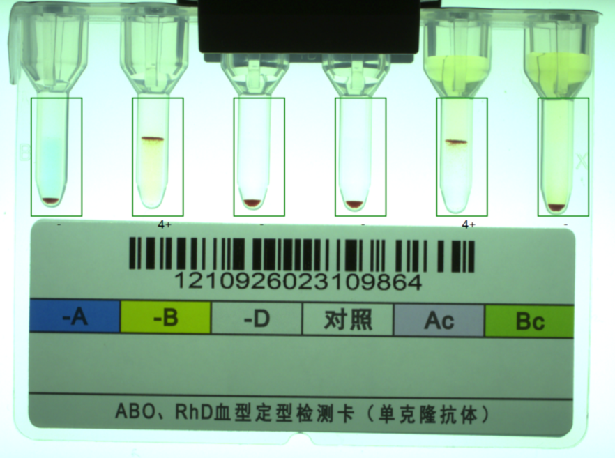 微柱凝胶法阳性图片