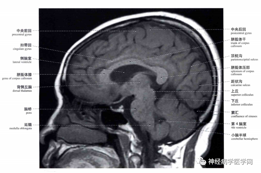 脑干横断面解剖图片