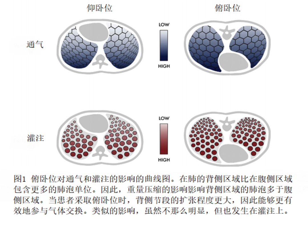 俯卧位通气流程图图片