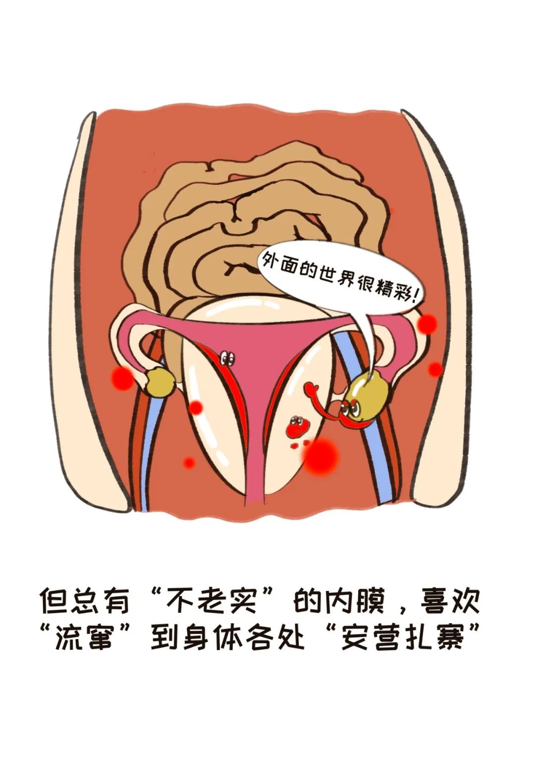 内异症的5大克星痛经的你一定要知道