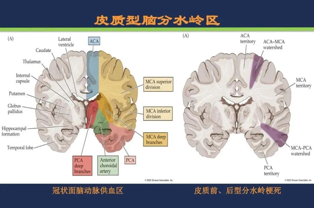 大脑分水岭区具体位置图片