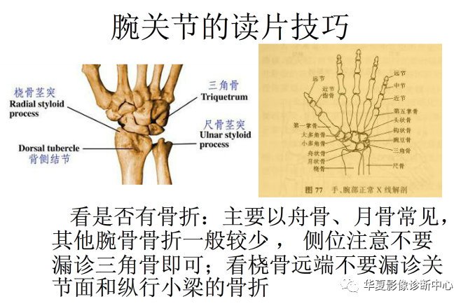 腕关节的读片技巧