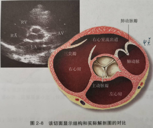 心脏超声八个标准切面图片