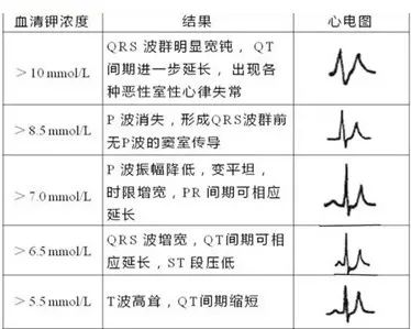 兔子高钾血症心电图图片