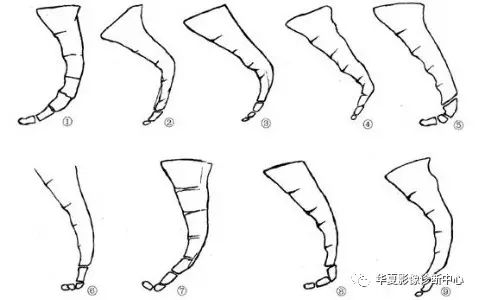 鱼钩骨折 医学界 助力医生临床决策和职业成长