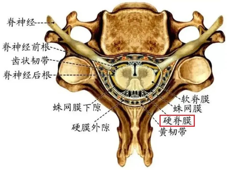 硬膜囊位置图图片