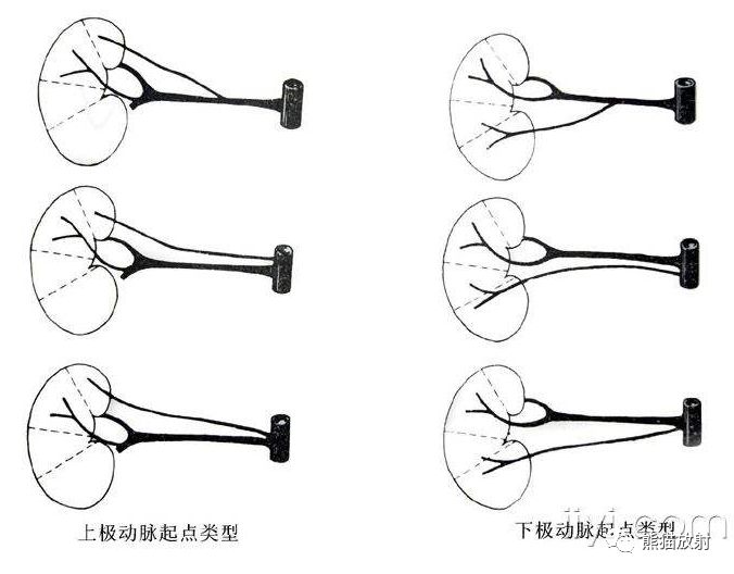 肾动脉分支解剖图片