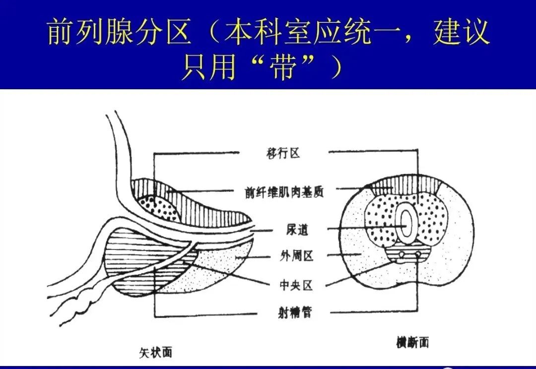 前列腺是由什么引起的的插图
