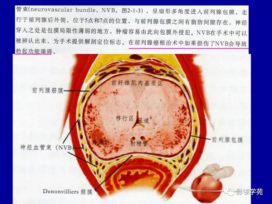 前列腺解剖及mri表現_醫學界-助力醫生臨床決策和職業成長