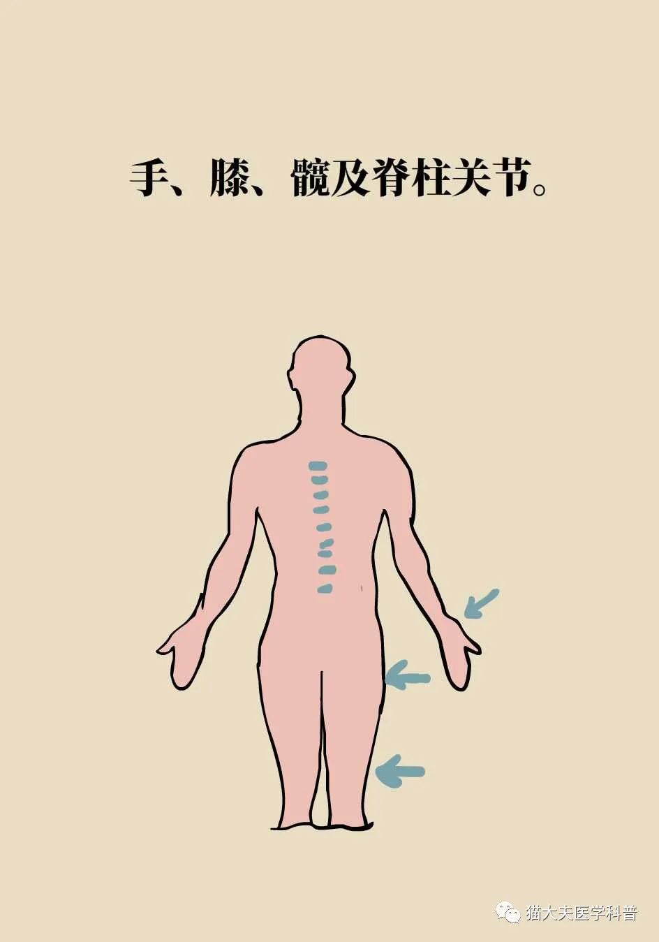 晨起身体僵硬原因和预防方法都在这里