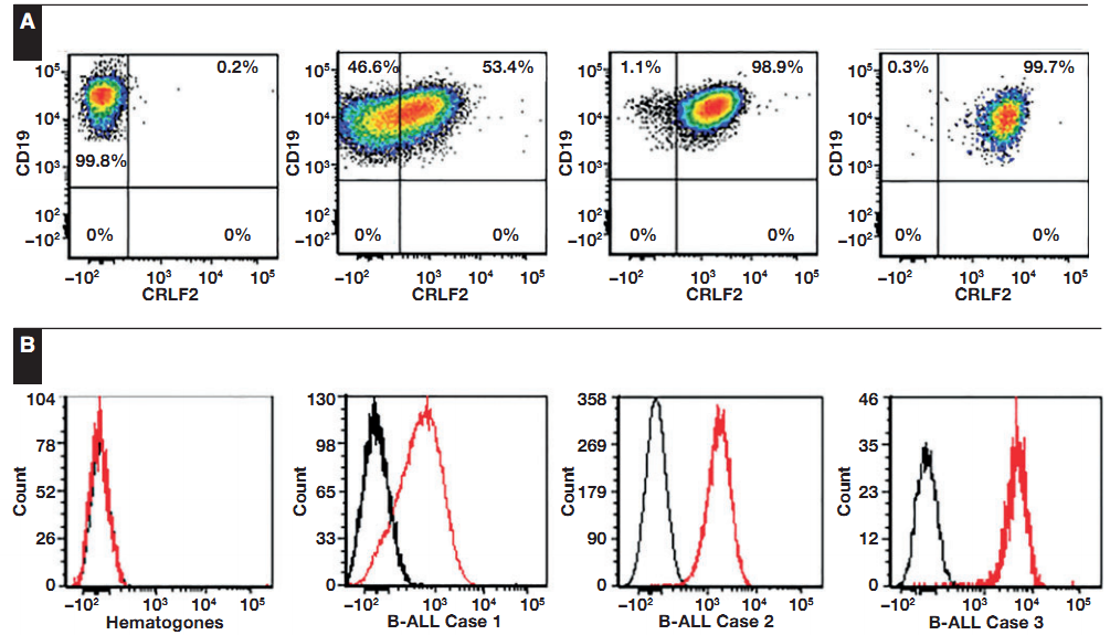 急性淋巴细胞白血病WHO分型汇总来了_医学界-助力医生临床决策和职业成长