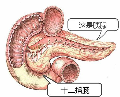 急性胰腺炎人財兩空是常事