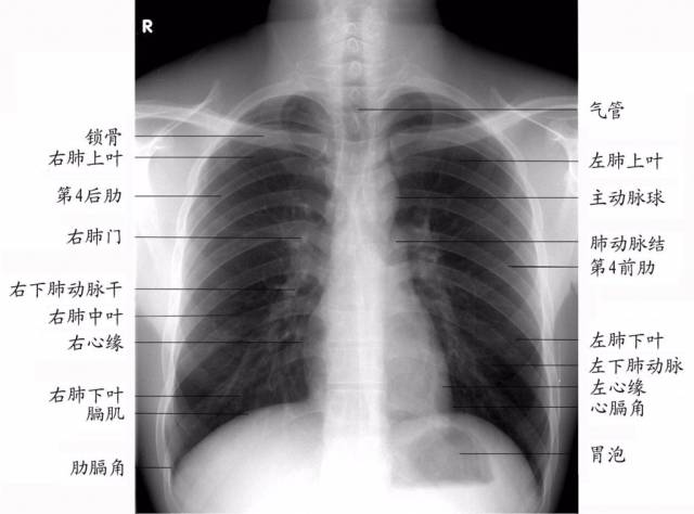 正常的肺门图片大全图片
