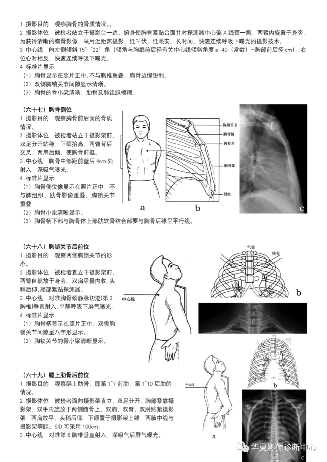 dr检查正常图片图片