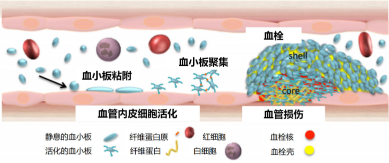 明明规律服用了抗血小板药物,为什么最后还是发生了血栓?