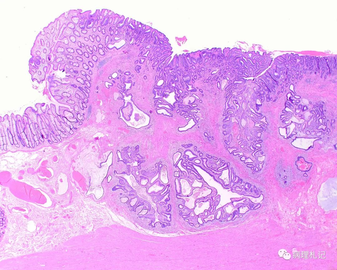 どのように診断されるのでしょうか?
