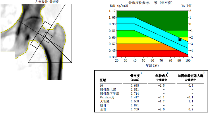 谈骨论今今天就来和大家谈一谈dxa骨密度测量