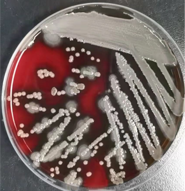 肺炎双球菌培养基图片