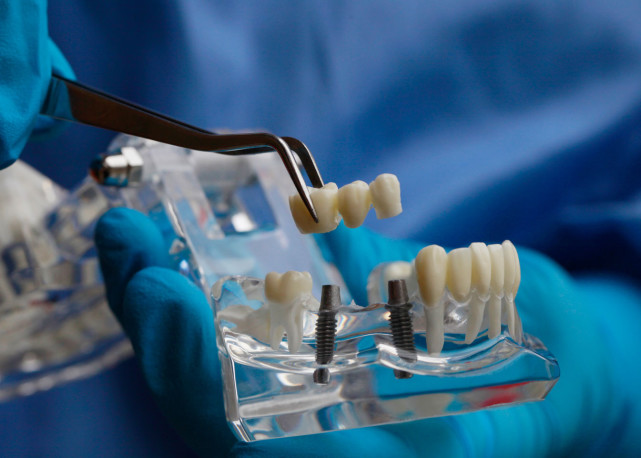 史上最难集采落地:种牙大降价,走了第一步_医学界-助力医生临床决策和