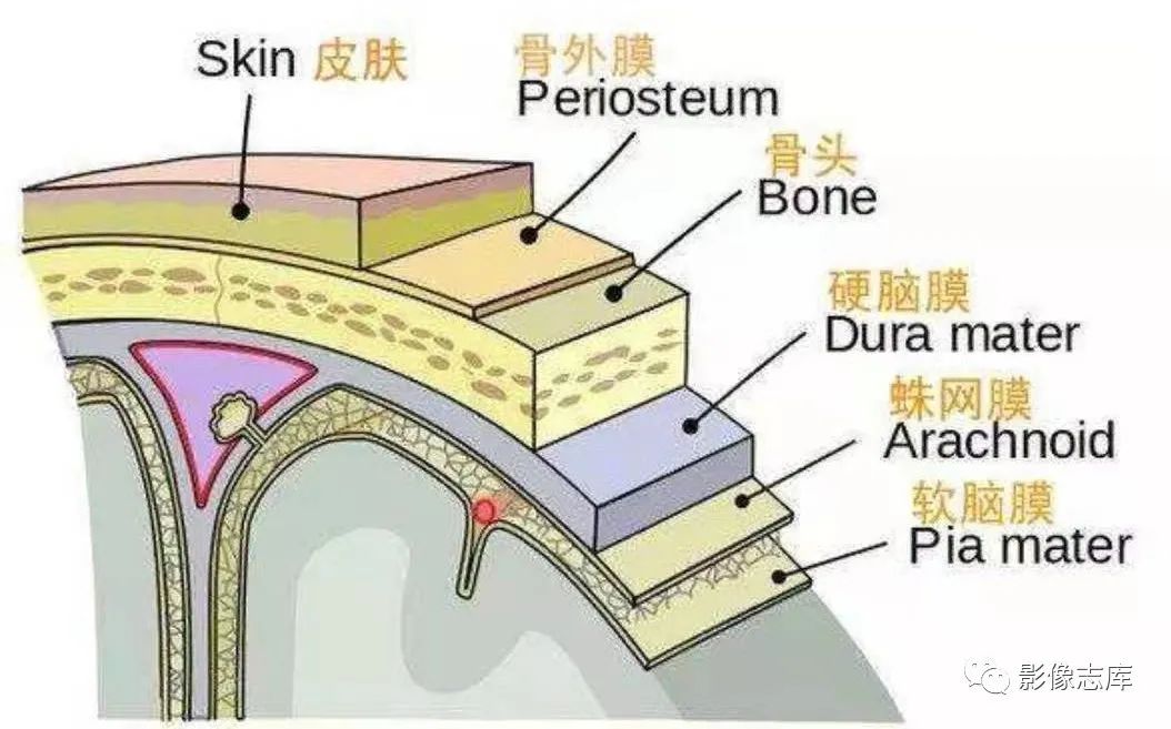 脑膜瘤最好的闺蜜:脑膜尾征的诊断标准