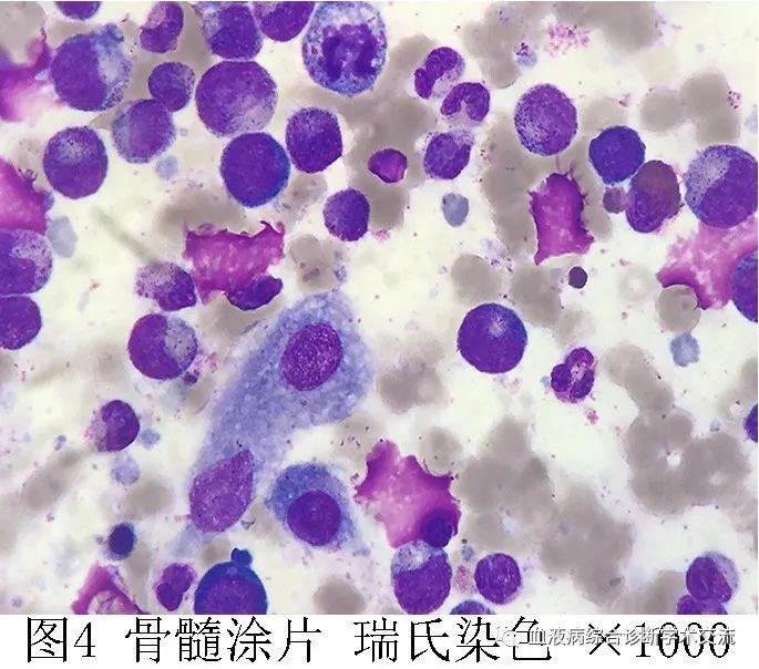 朗格汉斯细胞染色图片